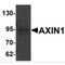 Axin 1 antibody, MBS150858, MyBioSource, Western Blot image 