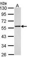 Coagulation Factor II Thrombin Receptor antibody, PA5-30590, Invitrogen Antibodies, Western Blot image 