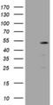 TBC1 Domain Family Member 13 antibody, NBP2-45985, Novus Biologicals, Western Blot image 