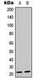 Mitochondrial Ribosomal Protein L21 antibody, LS-C354223, Lifespan Biosciences, Western Blot image 