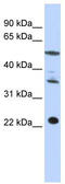 Centromere Protein M antibody, TA339360, Origene, Western Blot image 