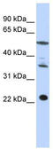 Centromere Protein M antibody, TA339360, Origene, Western Blot image 