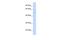 Tetrapeptide Repeat Homeobox 1 antibody, A17330, Boster Biological Technology, Western Blot image 