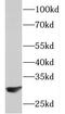 Proteasomal ATPase Associated Factor 1 antibody, FNab06095, FineTest, Western Blot image 