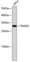 TNFRSF1A Associated Via Death Domain antibody, 13-070, ProSci, Western Blot image 