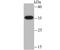 Corticosteroid 11-beta-dehydrogenase isozyme 1 antibody, NBP2-75392, Novus Biologicals, Western Blot image 