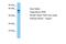 Alkaline Phosphatase, Biomineralization Associated antibody, A30227, Boster Biological Technology, Western Blot image 
