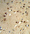Nuclear Receptor Coactivator 7 antibody, A05814-2, Boster Biological Technology, Immunohistochemistry paraffin image 