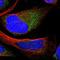 Thymidine Phosphorylase antibody, NBP1-84916, Novus Biologicals, Immunofluorescence image 