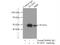 Transcription Factor AP-2 Gamma antibody, 14572-1-AP, Proteintech Group, Immunoprecipitation image 