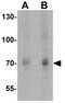 Tripartite Motif Containing 33 antibody, GTX31545, GeneTex, Western Blot image 