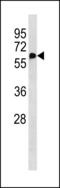 Nicotinate Phosphoribosyltransferase antibody, MBS9212025, MyBioSource, Western Blot image 