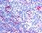 Neuroepithelial Cell Transforming 1 antibody, GTX25914, GeneTex, Immunohistochemistry paraffin image 