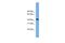 Ankyrin repeat and MYND domain-containing protein 2 antibody, PA5-70312, Invitrogen Antibodies, Western Blot image 