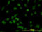 Interleukin 1 Receptor Associated Kinase 1 antibody, LS-B4360, Lifespan Biosciences, Immunofluorescence image 