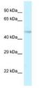 Transmembrane Protein 184B antibody, NBP1-79196, Novus Biologicals, Western Blot image 