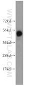 Histidyl-TRNA Synthetase antibody, 16375-1-AP, Proteintech Group, Western Blot image 