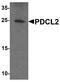 Phosducin Like 2 antibody, A10894, Boster Biological Technology, Western Blot image 