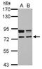 Coiled-Coil Domain Containing 151 antibody, NBP2-15744, Novus Biologicals, Western Blot image 