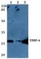 TIMP Metallopeptidase Inhibitor 4 antibody, A07131S206, Boster Biological Technology, Western Blot image 