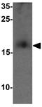 CD59 Molecule (CD59 Blood Group) antibody, GTX31524, GeneTex, Western Blot image 