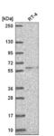 Ribosomal RNA Processing 8 antibody, NBP2-55730, Novus Biologicals, Western Blot image 