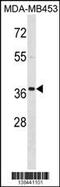 AAH17021 antibody, 59-857, ProSci, Western Blot image 