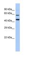 Transmembrane And Tetratricopeptide Repeat Containing 2 antibody, orb325439, Biorbyt, Western Blot image 