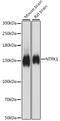 Neurotrophic Receptor Tyrosine Kinase 1 antibody, 16-139, ProSci, Western Blot image 