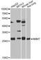 Nicotinamide N-Methyltransferase antibody, A14030, ABclonal Technology, Western Blot image 