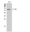 Interleukin 10 Receptor Subunit Alpha antibody, STJ97325, St John
