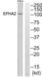 EPH Receptor A2 antibody, abx015158, Abbexa, Western Blot image 