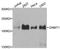 DNA Methyltransferase 1 antibody, orb167401, Biorbyt, Western Blot image 