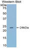 Adenine Phosphoribosyltransferase antibody, LS-C292636, Lifespan Biosciences, Western Blot image 