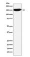 Carbamoyl-Phosphate Synthase 1 antibody, M01320-1, Boster Biological Technology, Western Blot image 