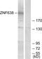 Zinc Finger Protein 638 antibody, PA5-38681, Invitrogen Antibodies, Western Blot image 