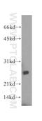 Lysophospholipase Like 1 antibody, 16146-1-AP, Proteintech Group, Western Blot image 