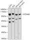 Protocadherin Beta 4 antibody, 18-078, ProSci, Western Blot image 