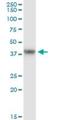 GRB2 Related Adaptor Protein 2 antibody, H00009402-M01, Novus Biologicals, Immunoprecipitation image 