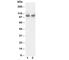 Fibroblast Growth Factor Receptor 2 antibody, R30342, NSJ Bioreagents, Western Blot image 