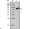 AXL Receptor Tyrosine Kinase antibody, LS-C812370, Lifespan Biosciences, Immunofluorescence image 