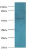 Leukocyte Immunoglobulin Like Receptor A2 antibody, A59622-100, Epigentek, Western Blot image 