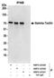 Taxilin Gamma antibody, NBP2-22331, Novus Biologicals, Immunoprecipitation image 