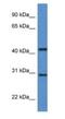 Alkaline Ceramidase 1 antibody, NBP1-74125, Novus Biologicals, Western Blot image 