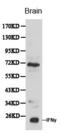 Interferon Gamma antibody, LS-C192619, Lifespan Biosciences, Western Blot image 