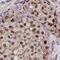 BMI1 Proto-Oncogene, Polycomb Ring Finger antibody, MAB33342, R&D Systems, Immunohistochemistry paraffin image 