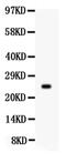 Prolactin antibody, PA5-79873, Invitrogen Antibodies, Western Blot image 