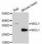 MCL1 Apoptosis Regulator, BCL2 Family Member antibody, abx125365, Abbexa, Western Blot image 