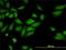 Rho Associated Coiled-Coil Containing Protein Kinase 2 antibody, H00009475-M01, Novus Biologicals, Immunofluorescence image 