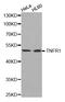 TNF Receptor Superfamily Member 1A antibody, MBS9414033, MyBioSource, Western Blot image 